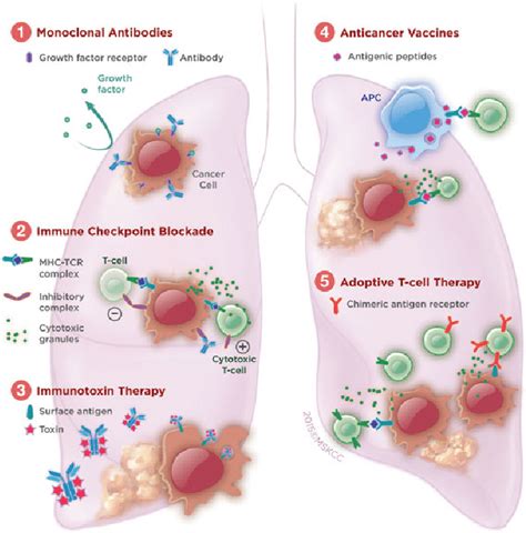 Current Immunotherapeutic Strategies For Non Small Cell Lung Cancer
