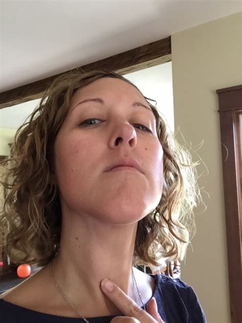 To help raise awareness, we wanted to show you photos of people living with thyroid cancer as well as thyroid cancer survivors. I was diagnosed with thyroid cancer