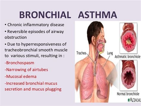 The pathophysiological stage of bronchial asthma is characterized by the development of bronchospasm, edema of the mucous membrane and infiltration of the bronchial wall by cellular elements, inflammation, hypersecretion of mucus. 19.bronchial asthma