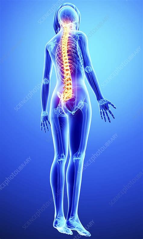 Back Pain Artwork Stock Image F0079972 Science Photo Library