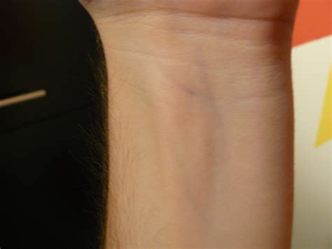 File Image Of A Wrist With Blue Veins Visible  Wikipedia