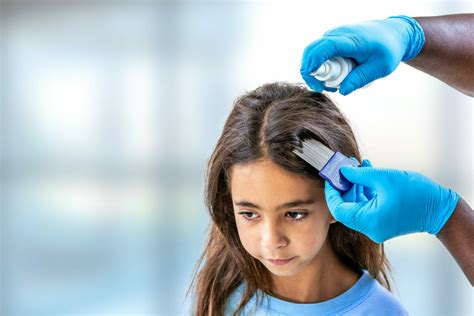 Video How To Treat Head Lice Au