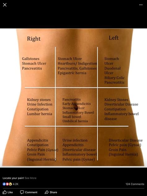 Epigastric Hernia Types