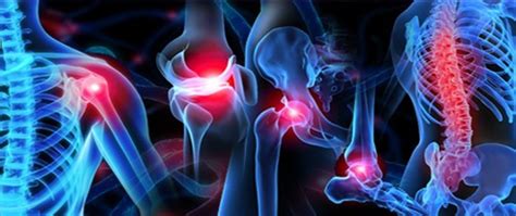 Two Common Orthopedic Conditions—and How To Treat Them