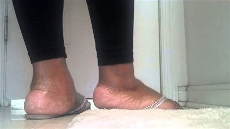 Thick Feet In Flip Flops Youtube