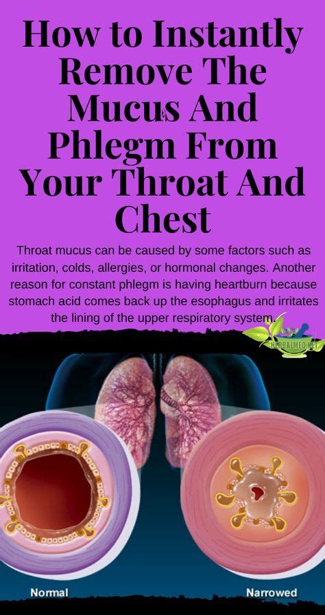 Causes Of Mucus In Throat