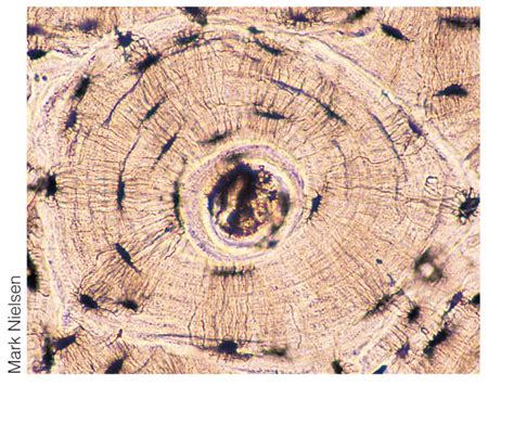 Bone Cross Section Under Microscope The Cortical Area Is A Measure
