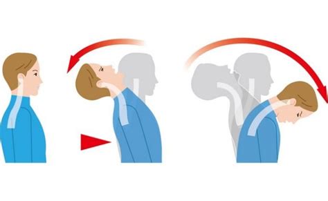 30 Most Common Causes And Top Treatment Of Neck Pain You Should Never