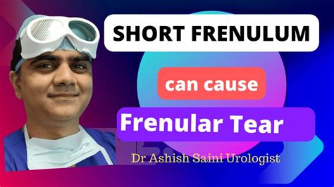Short Frenulum Or Frenulum Breve All You Need To Know Youtube