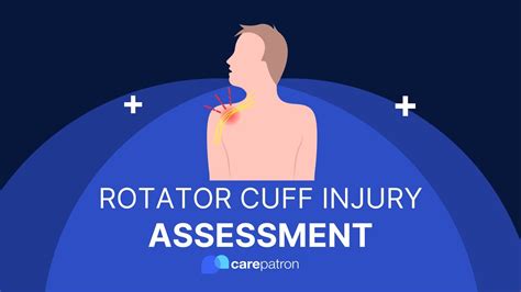 Rotator Cuff Injury Test Jobes Test Youtube