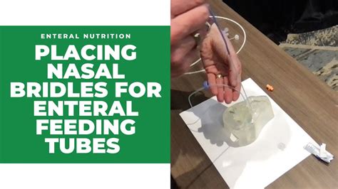 Placing Nasal Bridles For Enteral Feeding Tubes Youtube