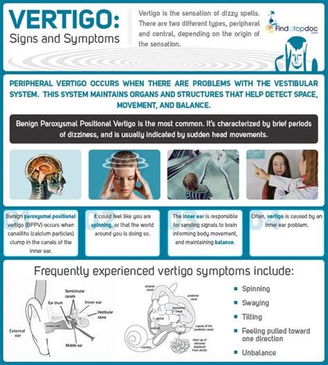 What Is Vertigo Facts About Vertigo Infographic Vertigo Treatment