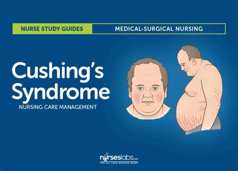 Cushings Syndrome Nursing Care Management And Study Guide