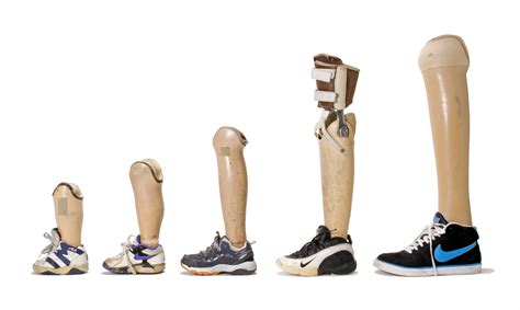 Pediatric Orthotic And Prosthetic Services Shriners Hospitals For