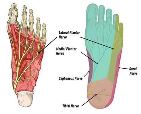 Lateral Plantar Nerve Entrapment Symptoms And Treatment