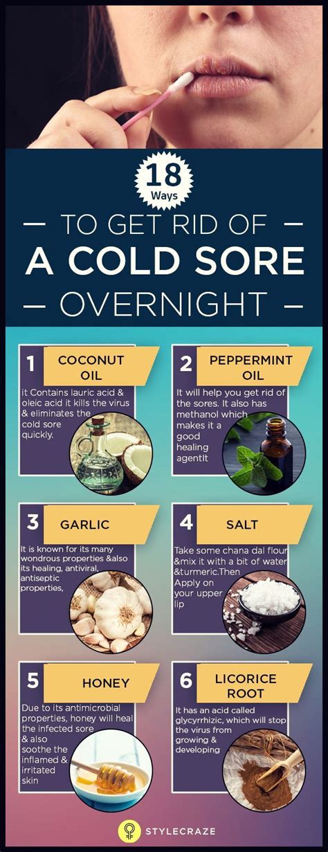 How To Get Rid Of Cold Sores 19 Effective Ways To Try Health Cold