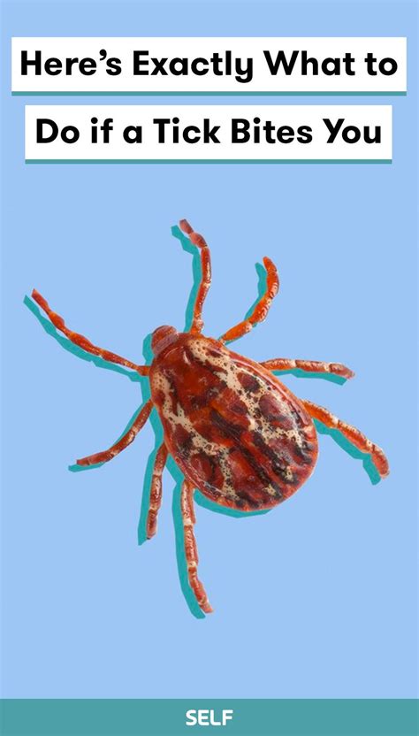 Here S How To Remove A Tick From Your Skin And What To Do Next If You Suspect That A Tick Bite