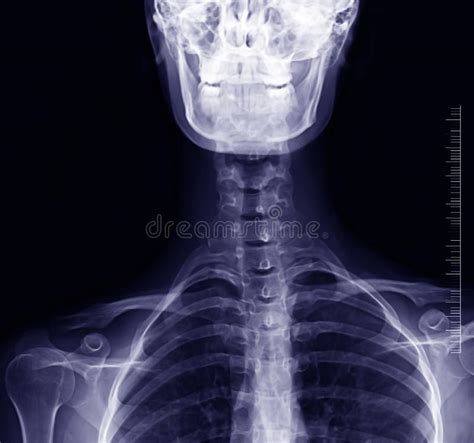 Human Skull Back View Photos Free And Royalty Free Stock Photos From