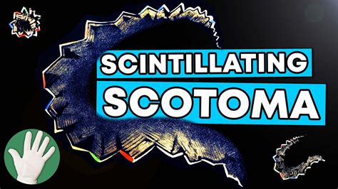 Scintillating Scotoma Objectivity 255 Youtube