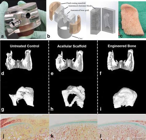 Engineering Anatomically Shaped Temporomandibular Joint Tmj Graftsa