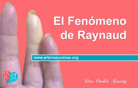 El Fenómeno De Raynaud Arterias Y Venas