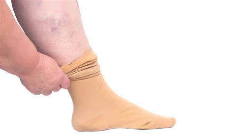 compression stockings for swollen feet south jersey podiatrist south jersey foot doctor dr