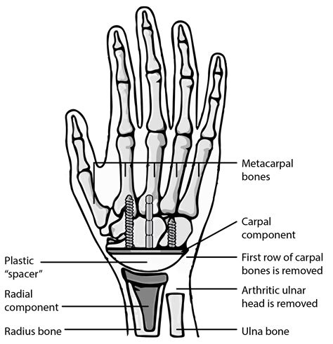 Carpals Definition Anatomy Anatomical Charts And Posters