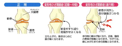 リハビリで実績のある疾患・症状 | 木村眼科・木村内科・木村 ...