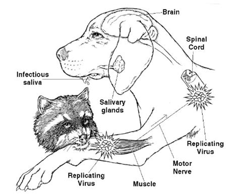 The initial symptoms of rabies are fever and often pain or an unusual or unexplained tingling, pricking or burning sensation (paraesthesia) at the wound site. Human Rabies Mortality in India: Why Is This Still An ...