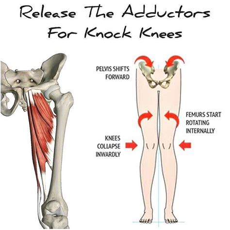 Tight Adductors Knock Knees [adductor Education] I Posted A While Ago A 🎥 In Which I