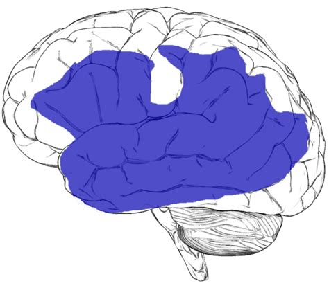 Os sintomas pulmonares são graves (p. afasia progressiva primária - Primary progressive aphasia ...