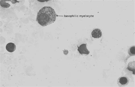 Hls Bone Marrow And Hemopoiesis Bone Marrow Smear Basophilic