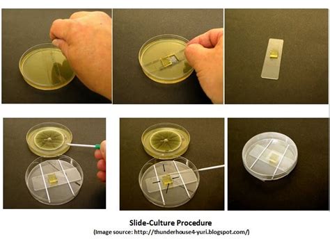Slide Culture For Fungi Principle Procedure Results • Microbe Online