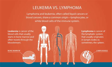 Lymphoma Vs Leukemia Understanding The Differences