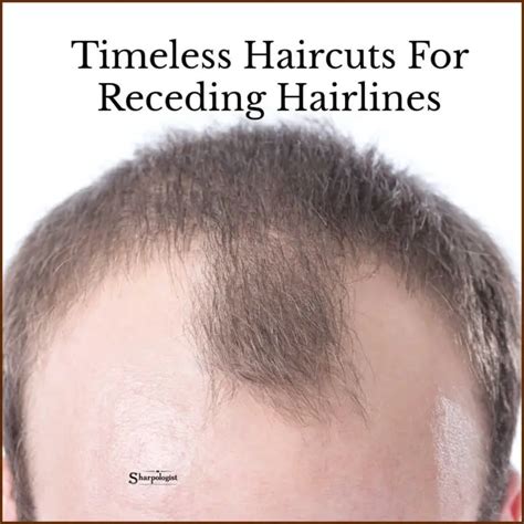 4 Classic Haircuts For Men With Receding Hairlines Sharpologist