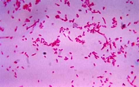 Gram Negative Bacilli Rods Microbiology Learning The Why Ology Of