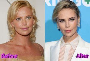 Charlize Theron Before And After Plastic Surgery Plastic Surgery Mistakes