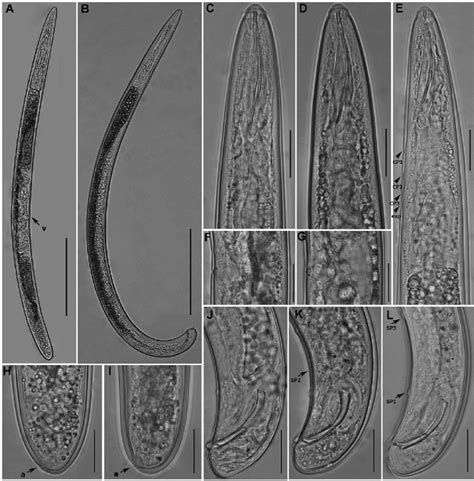 Light Photomicrographs Of Trichodorus Hangzhouensis Sp Nov Paratypes