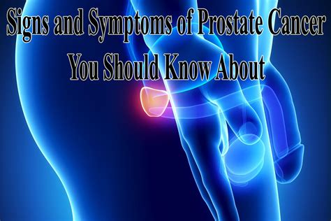 Prostate cancer is known to have a particular affinity for spreading or metastasizing to the bones especially the lower spine, pelvis, and femur. Pin on Health