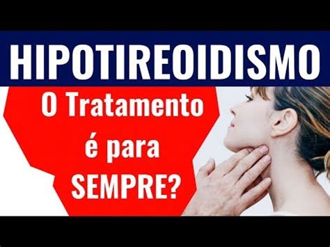 Hipotireoidismo O Tratamento Pra Sempre Dr Rogerio Leite Youtube