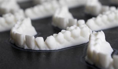 El Mercado De La Impresión 3d Dental En Pleno Boom 3dnatives