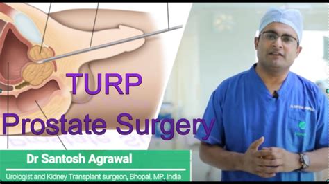 Prostate TURP I परसटट लजर सरजर I HOLEP I Prostate Laser surgery I prostate Operation