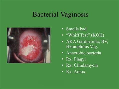 Bacterial Vaginosis Symptoms Bacterial Vaginosis Bacterial