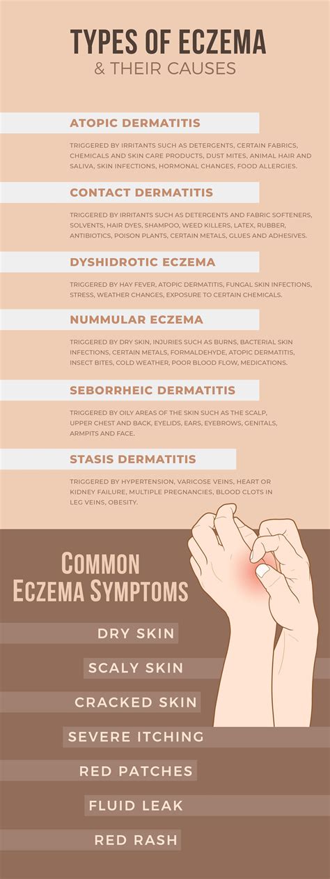 10000印刷√ Eczema Causes 129239 Eczema Causes And Treatment