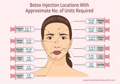 How Long Does It Take To See Botox Results With Timeline