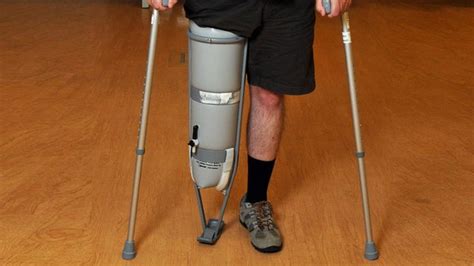 Lesser Known Things About Prosthetic Legs Welcome To