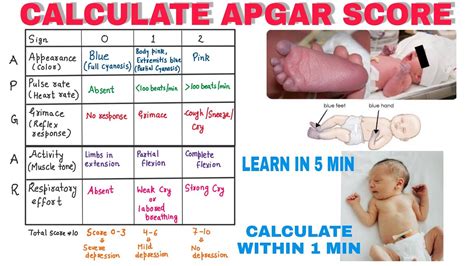 How To Calculate Apgar Score Pediatrics Youtube