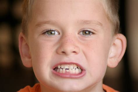 The healing process strengthens the gums. Taysoms in the News: Loose Tooth