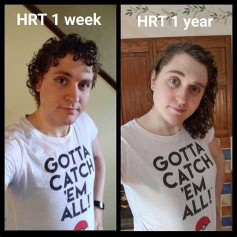 1 Year On Hormones Today Mtf 26 27 Rtranstimelines