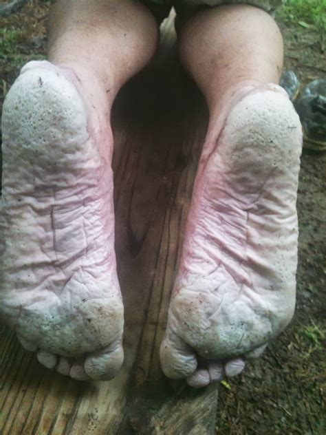 Get Hiking Zombie Feet